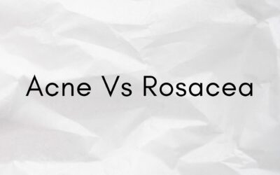 Acne Vs Rosacea – How to Identify?