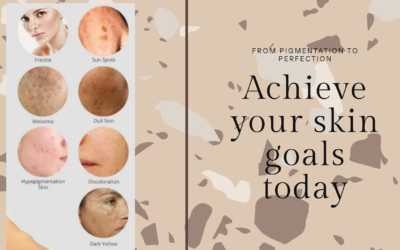 FROM PIGMENTATION TO PERFECTION